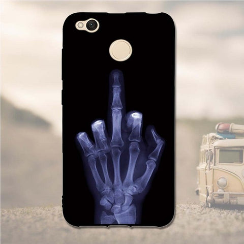 3D Pattern Case For Xiaomi Redmi 4X Case 5.0" Soft TPU Silicone Back Cover Cases For Xiaomi Redmi 4X Redmi 4 X Phone Case fundas - watchwomen